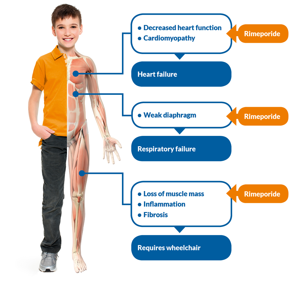 About Duchenne Muscular Dystrophy Esperare Foundation 